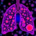 unraveling-small-cell-lung-cancer:-a-multi-omic-approach