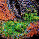 ibd-linked-to-colon-cancer-through-tl1a-driven-immune-pathway