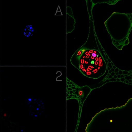 grem1-boosts-colorectal-cancer-spread-via-acvr1c