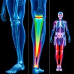 linking-bmd,-frax,-and-femoral-strength-in-seniors