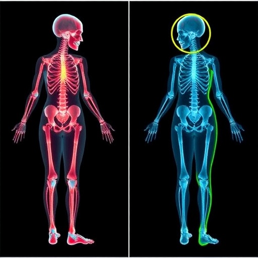 assessing-osteoporotic-fracture-risk-in-armenian-women