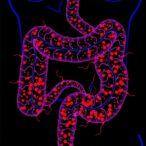 usp7:-key-immunotherapeutic-target-in-colorectal-cancer