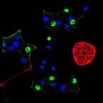inhibiting-itgb2-axis-suppresses-melanoma-growth