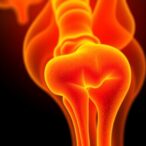 targeting-oxldl-boosts-pd-1-immunotherapy-in-osteosarcoma