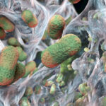 bacterial-biofilms-unexpectedly-found-inside-most-common-kidney-stones