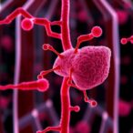 new-targets-identified-for-nonalcoholic-steatohepatitis-treatment