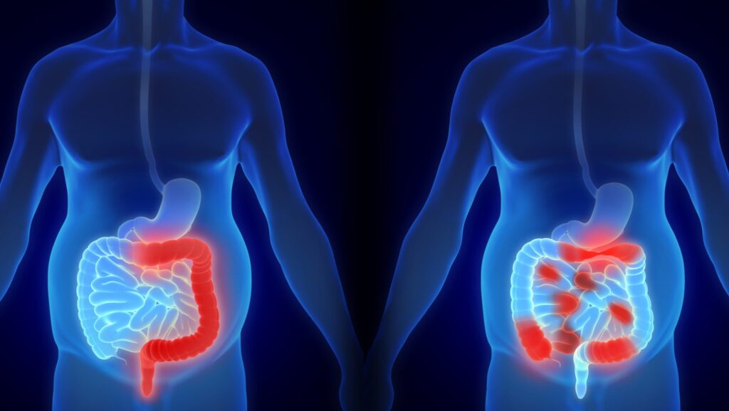 boehringer-pens-e1.05b-deal-for-simcere’s-preclinical-ibd-bispecific