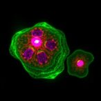 phosphorylated-tau-disrupts-protective-envelopes’-functionality