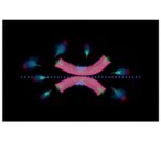 recognizing-pediatric-chordoma’s-poorly-differentiated-subtype