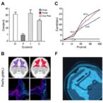 crocin-and-eugenol-boost-radiosensitivity-in-oral-cancer