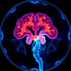 dalpicilib-plus-cetuximab-shows-promise-in-resistant-head-and-neck-cancer