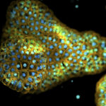 ixcells-and-rosebud-biosciences-partner-on-organoid-based-rare-disease-models