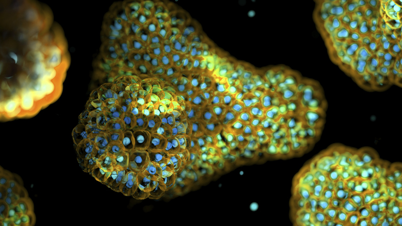 ixcells-and-rosebud-biosciences-partner-on-organoid-based-rare-disease-models