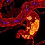 linc00857-drives-pancreatic-cancer-via-mir-130b/rhoa