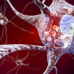 nautilus,-weill-cornell-team-up-to-apply-single-molecule-proteomics-tech-to-parkinson’s