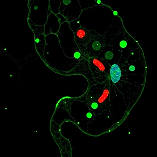 epithelial-wnt-secretion-fuels-gastric-cancer-progression