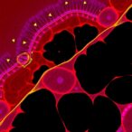 shear-stress-triggers-endothelial-to-mesenchymal-transition-in-endothelium