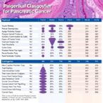 new-molecular-classifier-for-pancreatic-cancer-unveiled