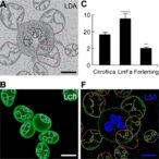 circrnf10-regulates-β-catenin-in-lung-adenocarcinoma