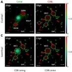 clonal-expansion-of-cd8⁺-t-cells-in-lecanemab-aria