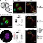 anti-tlr2-therapy-limits-α-synuclein-spread-in-models