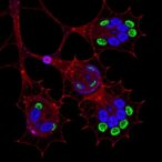 circkiaa1617-enhances-stemness-in-er-positive-breast-cancer