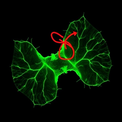 mme-identified-as-key-target-of-notoginsenoside-r1