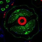 unlocking-tumor-lymph-node-metastasis-with-single-cell-omics
