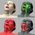 evaluating-3d-vs-conventional-simulators-for-cricothyrotomy