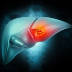 mutation-map-indicates-how-alterations-in-key-cancer-gene-influence-tumor-growth