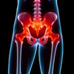 assessing-hip-fracture-risk:-costa-rica’s-unique-insights