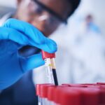 quest-launches-residual-disease-blood-test-for-multiple-myeloma