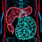 oxct1-drives-liver-metastasis-in-colorectal-cancer:-new-insights