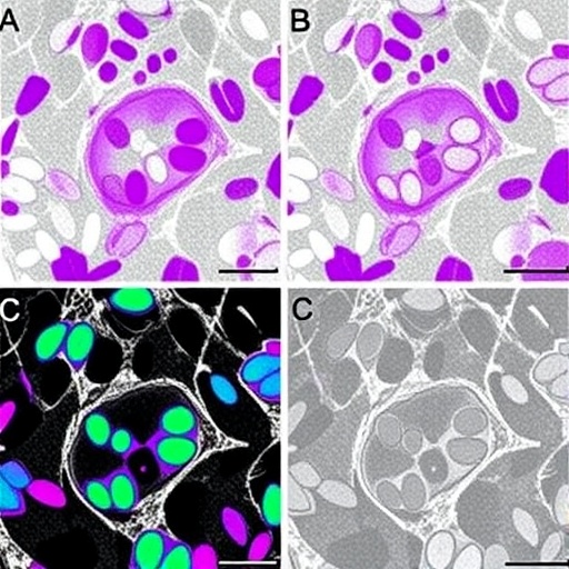 fam83h-as1:-new-noninvasive-ovarian-cancer-biomarker