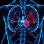 ai-tool-promises-to-pinpoint-which-men-over-60-with-prostate-cancer-need-follow-up