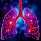 irf5’s-role-in-emphysema-via-nlrp3-and-ly6c-cells
