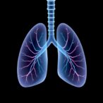 sildenafil’s-variable-impact-on-preemie-lung-hypertension