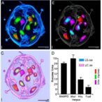 ranbp2-controls-inflammation-in-influenza-induced-encephalopathy