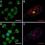 palmitoylation-of-tfr1-drives-platelet-ferroptosis-and-exacerbates-liver-damage-in-heat-stroke