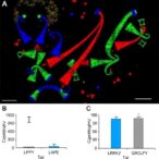 lrrk2r1627p-mutation-boosts-gut-inflammation,-α-synuclein