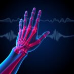 decoding-phantom-limb-movements-via-intraneural-signals