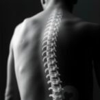 how-do-certain-factors-influence-life-expectancy-in-individuals-with-spina-bifida?