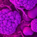 new-lupus-model-uncovers-keratinocytes-as-key-drivers-of-disease-progression