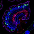 fpr2-facilitates-intestinal-epithelial-repair-following-injury