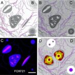 foxf2-controls-vascular-signaling-after-neonatal-lung-injury