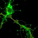 choline-reduces-bilirubin’s-impact-on-l1cam-phosphorylation