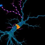 loss-of-function-cd99l2-variants-trigger-x-linked-ataxia