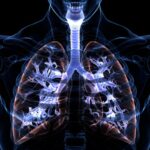 boehringer-axes-inhaled-gene-therapy-after-viewing-cystic-fibrosis-data