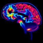 neuromelanin-mri-beats-free-water-in-early-parkinson’s