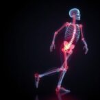osteoporosis:-overlooked-key-in-fall-prevention